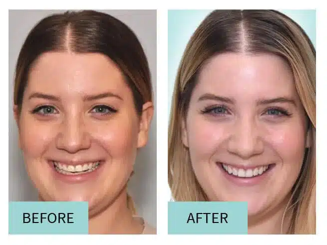 cosmetic dentist sioux falls