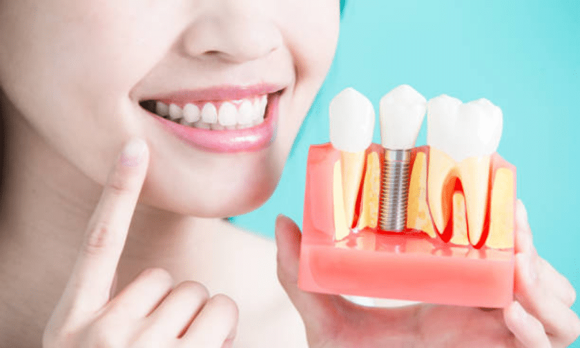 dental implants Sioux Falls