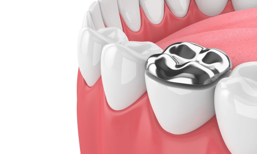 Mercury Free Dentistry Benefits