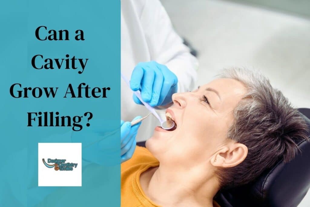 Can Cavities Develop After a Filling?