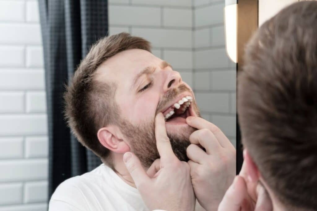 Why Replacing Missing Teeth Matters