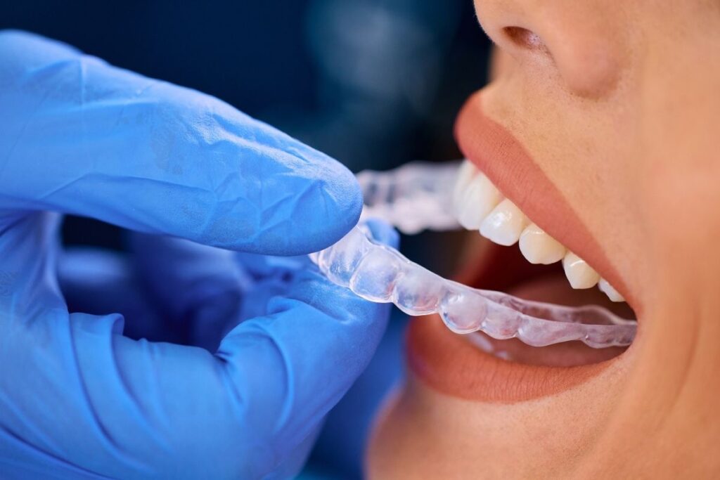 How Does Invisalign Move Teeth