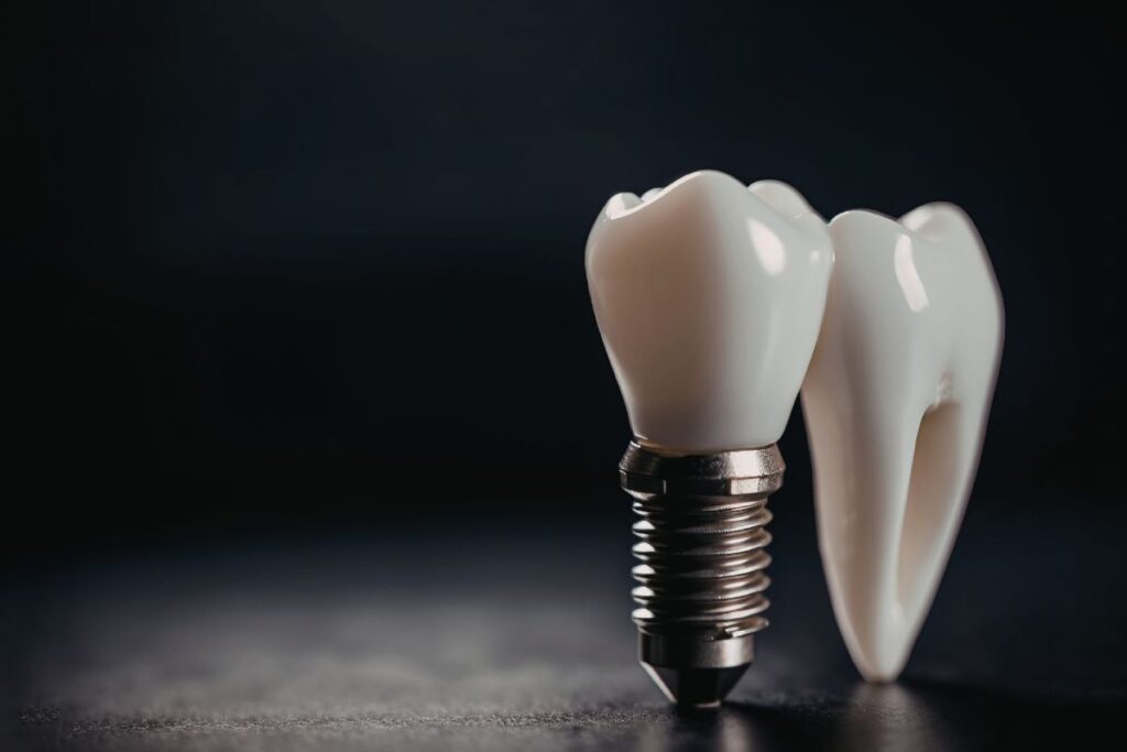 Are Dental Implants Safe