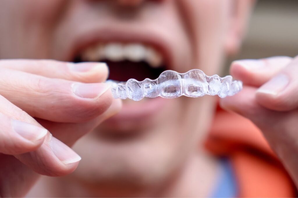 How Long Does Invisalign Treatment Take